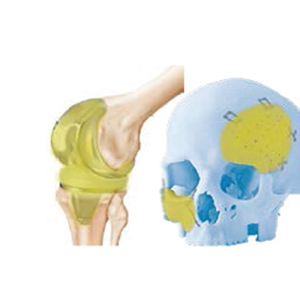 New Year, New You: How an Anti-Inflammatory Coating Can Keep Joint Implants Moving Pain-Free for Longer
