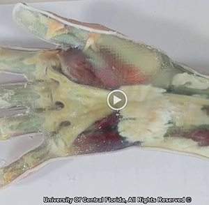 The medical modeling capabilities of UCF’s Prototype Development & 3D Printing Lab