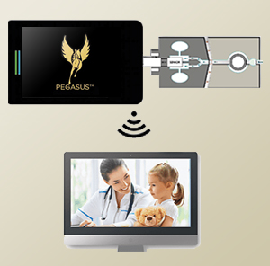 Pegasus device, sensor and monitor