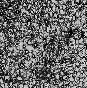 Ultrasound-Responsive Nanobubbles for Osteoporosis Treatment